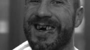 WWE: जब रेसलर्स को लगी घातक चोट और रिंग में ही तुड़वा बैठे अपने दांत