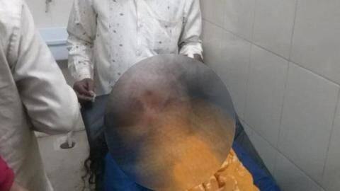 महिला ने तीन तलाक का केस वापस लेने से मना किया तो काट दी नाक महिला ने तीन तलाक का केस वापस लेने से मना किया तो काट दी नाक