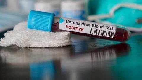 कोरोना वायरस: ICMR की सलाह, दो दिन तक रैपिड टेस्ट किट का प्रयोग न करें राज्य कोरोना वायरस: ICMR की सलाह, दो दिन तक रैपिड टेस्ट किट का प्रयोग न करें राज्य