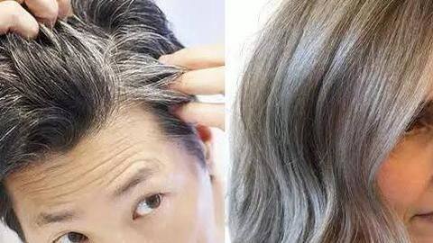 सफेद बालों को काला करने में मददगार साबित होंगे ये घरेलू उपाय सफेद बालों को काला करने में मददगार साबित होंगे ये घरेलू उपाय