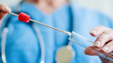 कोरोना: RT-PCR टेस्ट में आ रही झूठी निगेटिव रिपोर्ट, विशेषज्ञों ने दी CT स्कैन की सलाह कोरोना: RT-PCR टेस्ट में आ रही झूठी निगेटिव रिपोर्ट, विशेषज्ञों ने दी CT स्कैन की सलाह