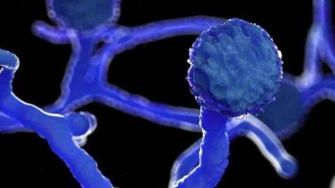 पंजाब: बिना कोरोना की चपेट में आए भी 32 लोगों को ब्लैक फंगस, डॉक्टरों ने चेताया पंजाब: बिना कोरोना की चपेट में आए भी 32 लोगों को ब्लैक फंगस, डॉक्टरों ने चेताया