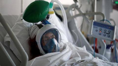 मध्य प्रदेश: ऑक्सीजन सपोर्ट हटाने से कोरोना संक्रमित शिक्षक की मौत, CCTV फुटेज में खुलासा मध्य प्रदेश: ऑक्सीजन सपोर्ट हटाने से कोरोना संक्रमित शिक्षक की मौत, CCTV फुटेज में खुलासा
