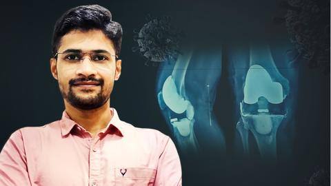 #NewsBytesExclusive: क्या कोरोना वायरस भी बन सकता है अर्थराइटिस का कारण? जानें विशेषज्ञ की राय #NewsBytesExclusive: क्या कोरोना वायरस भी बन सकता है अर्थराइटिस का कारण? जानें विशेषज्ञ की राय