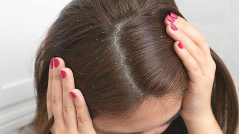 ड्राई स्कैल्प को ठीक करने के लिए अपनाएं ये घरेलू नुस्खे ड्राई स्कैल्प को ठीक करने के लिए अपनाएं ये घरेलू नुस्खे