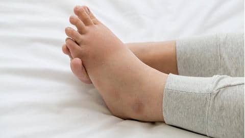वॉटर रिटेंशन के प्रभाव को कम करने में सहायक हैं ये योगासन, ऐसे करें अभ्यास वॉटर रिटेंशन के प्रभाव को कम करने में सहायक हैं ये योगासन, ऐसे करें अभ्यास