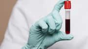 झारखंड: बच्चों को चढ़ाया संक्रमित खून, 5 मासूमों की HIV रिपोर्ट पॉजिटिव आने के बाद हड़कंप
