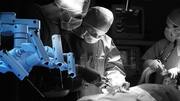 दिल्ली: रोबोट-समर्थित प्रक्रिया के जरिए व्यक्ति की हुई सफल सर्जरी
