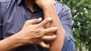 त्वचा के बैक्टीरियल और फंगल संक्रमण के बीच क्या होता है अंतर?