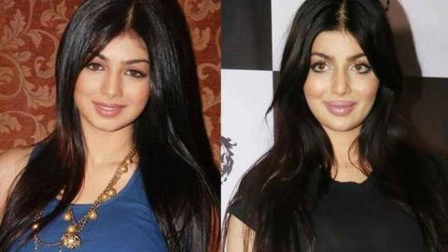 सर्जरी के बाद दिखने लगीं अलग सर्जरी के बाद दिखने लगीं अलग