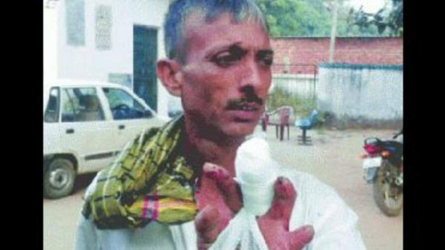 अनिल ने साल 2005 में काटी थी अपनी पहली अंगुली अनिल ने साल 2005 में काटी थी अपनी पहली अंगुली