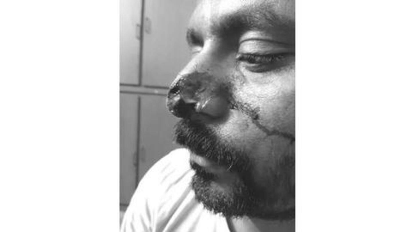 आरोपी के खिलाफ मामला दर्ज आरोपी के खिलाफ मामला दर्ज
