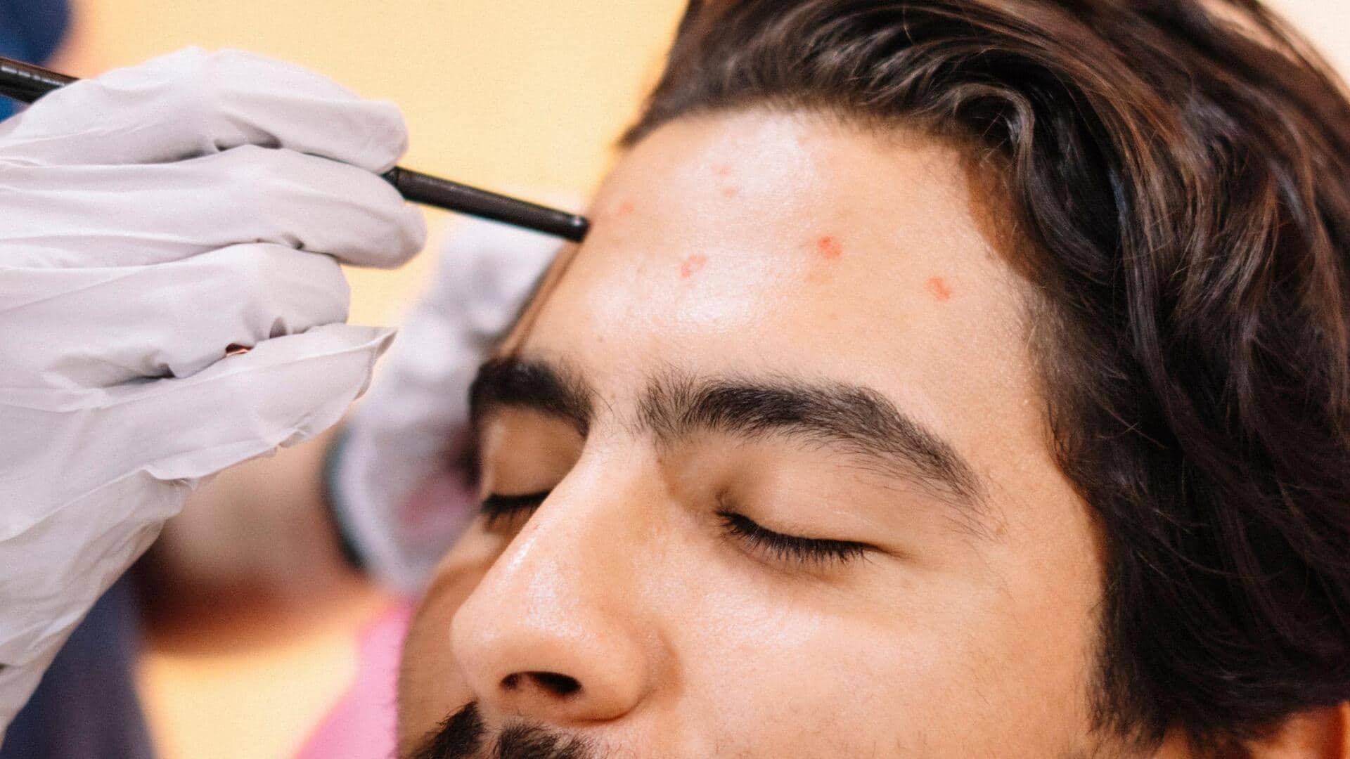 मानसून के दौरान मुंहासे होने का कारण बन सकते हैं ये 5 कारक
