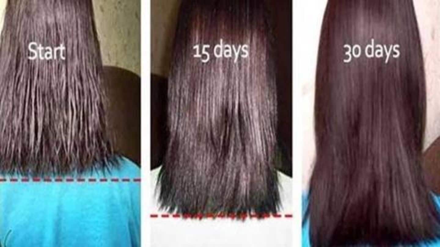 महीने भर में बालों को लंबा करना है तो अपनाएँ ये उपाय, होंगे फ़ायदे