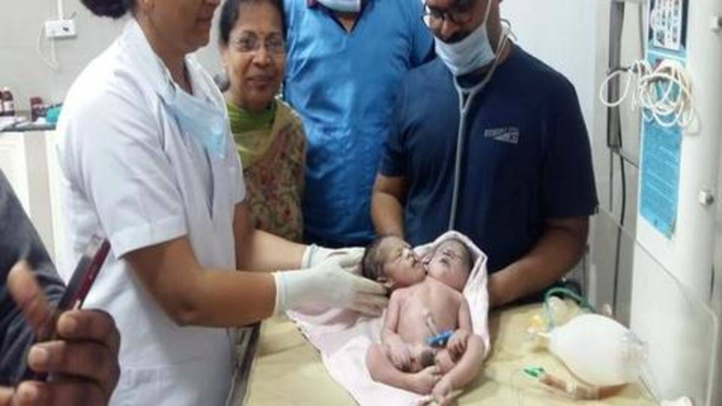 मध्य प्रदेश: महिला ने दिया दो सिर और तीन हाथ वाले बच्चे को जन्म, जानें