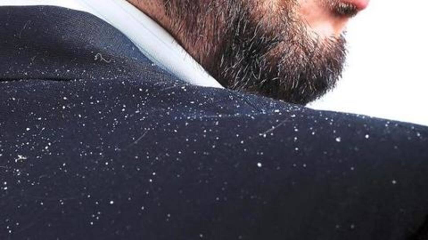 डैंड्रफ के लक्षण डैंड्रफ के लक्षण