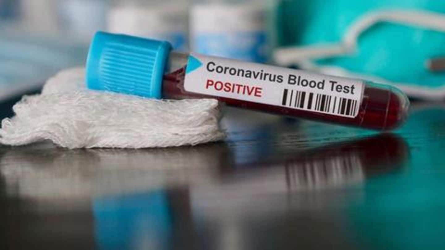 कोरोना वायरस: ICMR की सलाह, दो दिन तक रैपिड टेस्ट किट का प्रयोग न करें राज्य