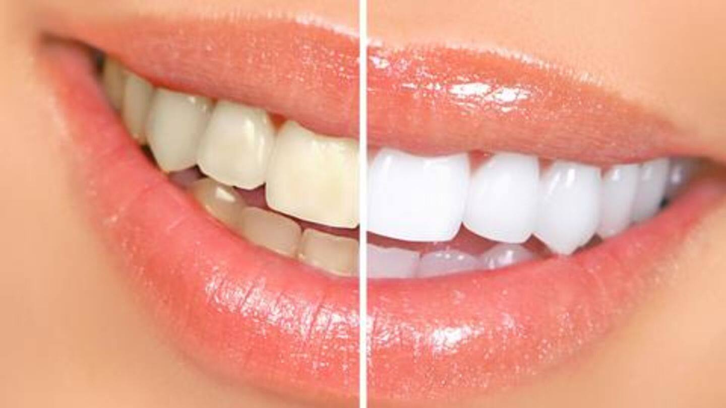 दांतों के पीलेपन से परेशान हैं? इन घरेलू उपायों का इस्तेमाल करके बनाएं चमकदार
