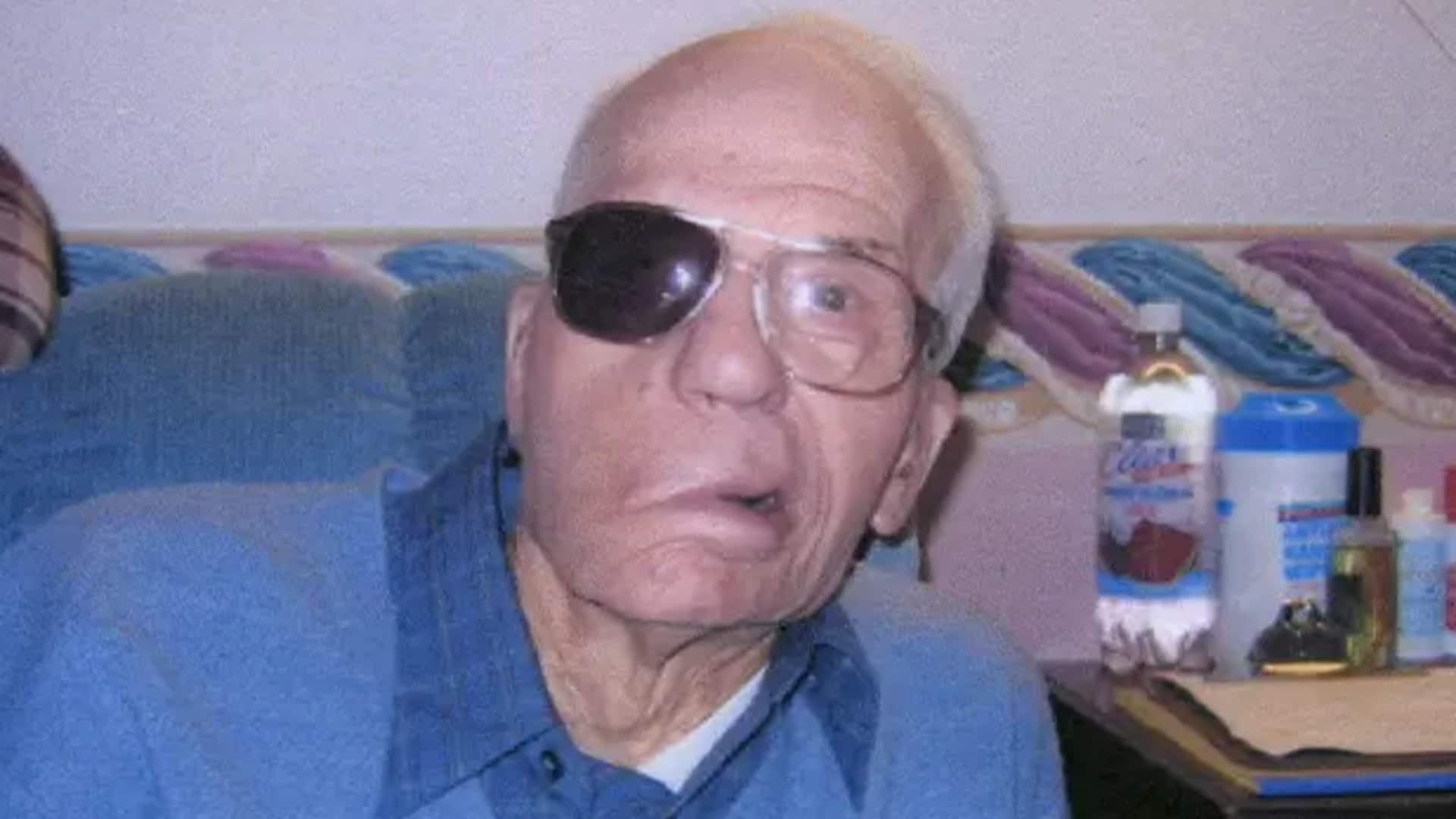 अमेरिका: सिर में गोली के साथ 94 साल जीवित रहा ये व्यक्ति, बनाया विश्व रिकॉर्ड
