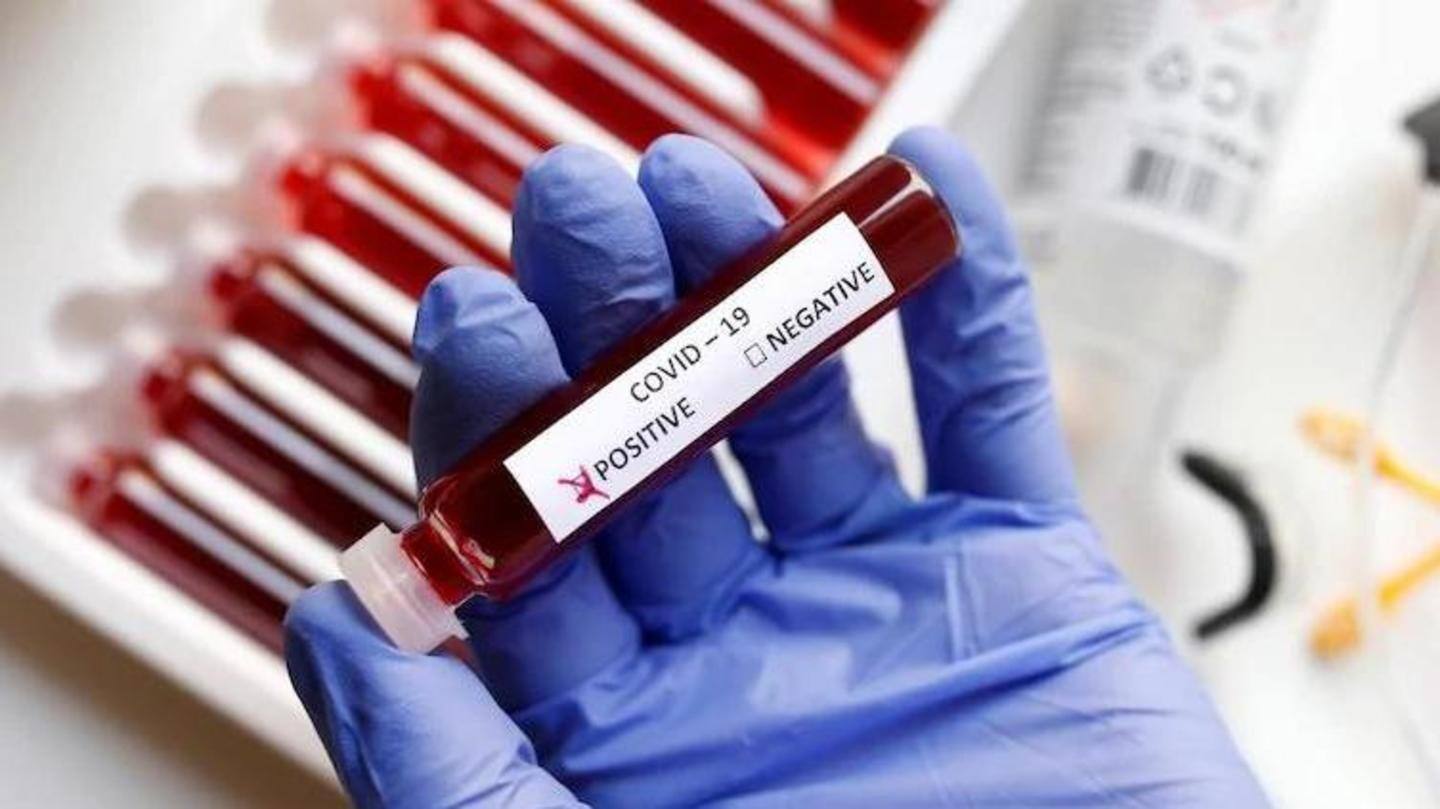 किन लोगों का RT-PCR टेस्ट किया जा सकता है? किन लोगों का RT-PCR टेस्ट किया जा सकता है?