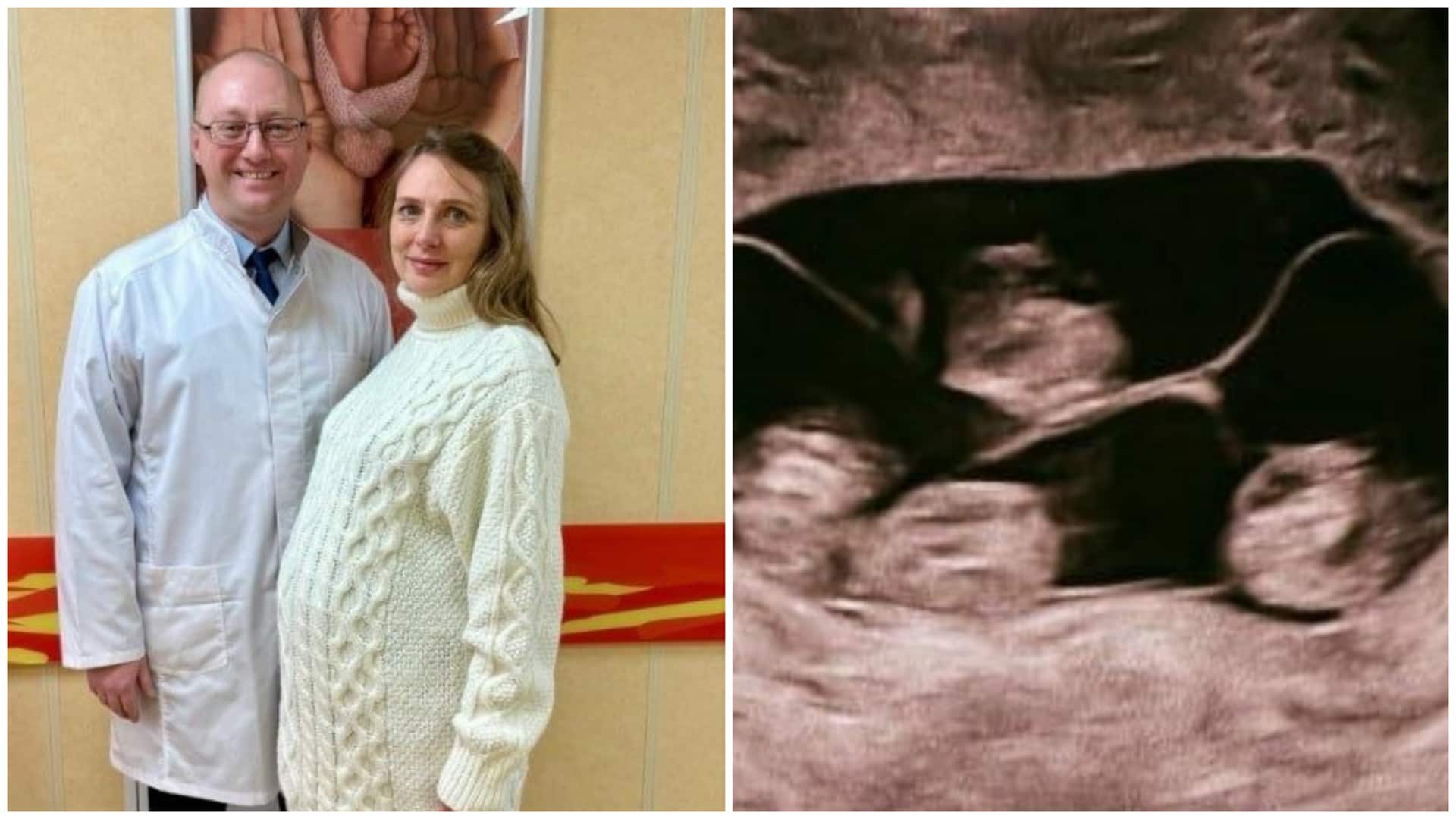 इस महिला ने दिया 4 बच्चियों को एक साथ जन्म, सभी दिखने में एक जैसी