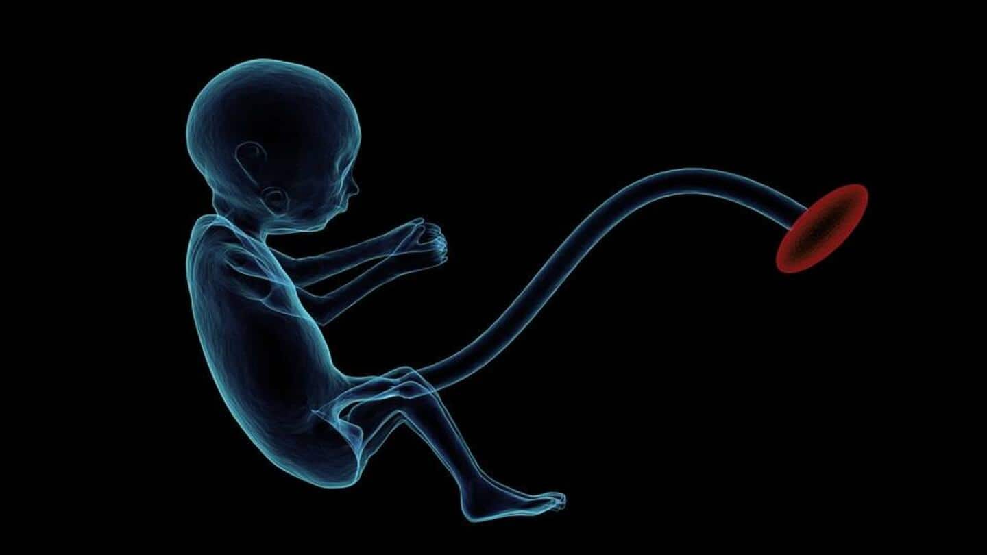 रांची: 21 दिन की बच्ची के पेट में मिले 8 भ्रूण, डॉक्टर्स हैरान