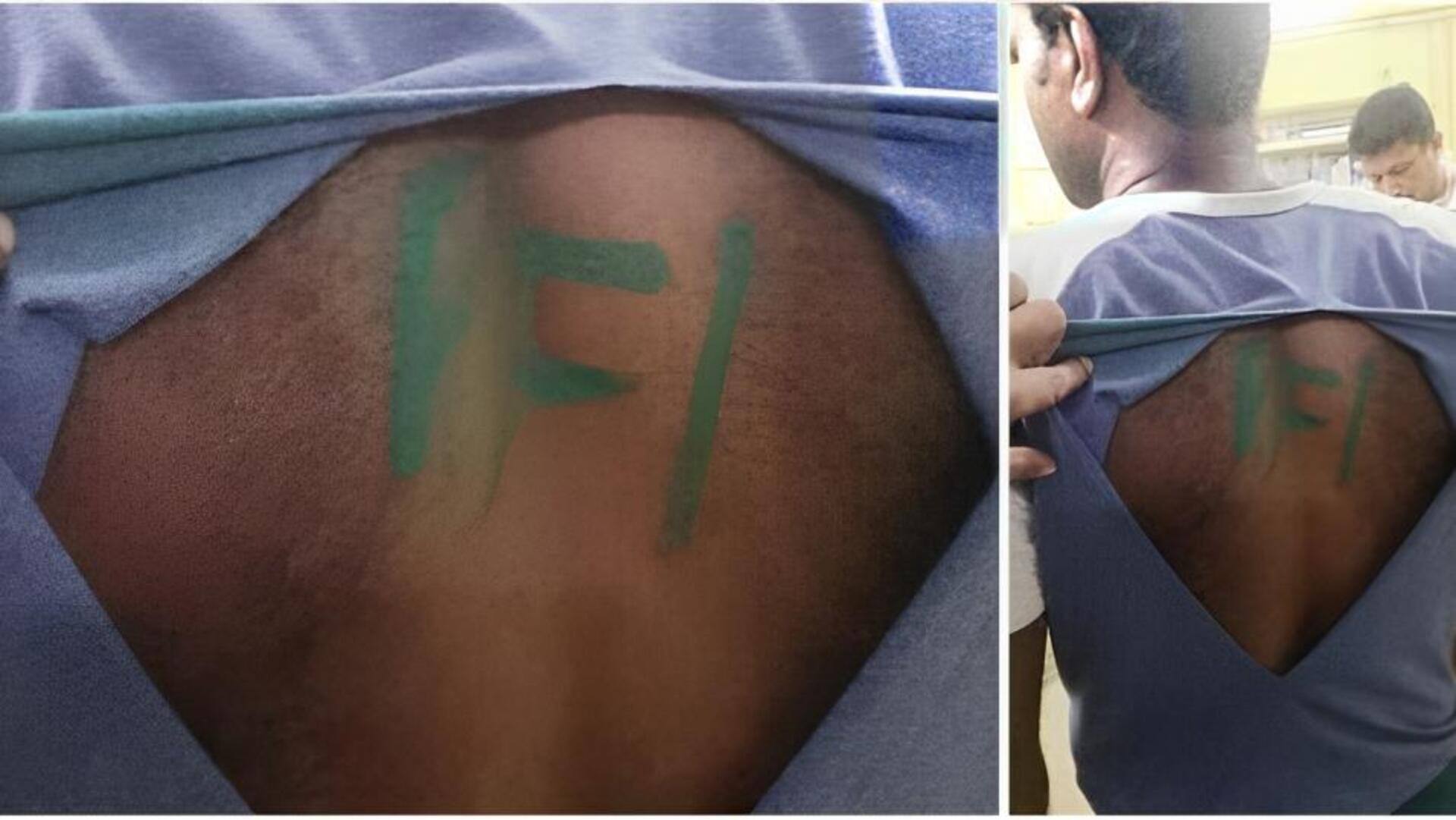 केरल: कोल्लम में 6 लोगों ने सेना के जवान के कपड़े फाड़े, पीठ पर PFI लिखा