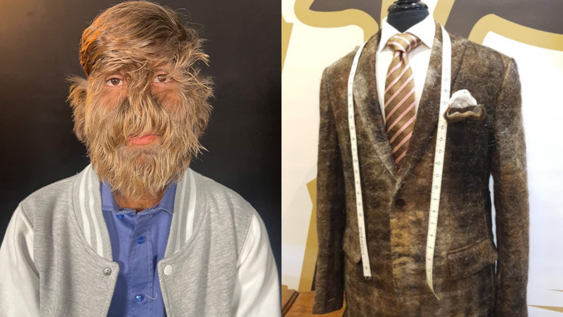 मूछों से बने सूट से लेकर सबसे लंबी दाढ़ी तक, बालों से जुड़े 5 विचित्र रिकॉर्ड