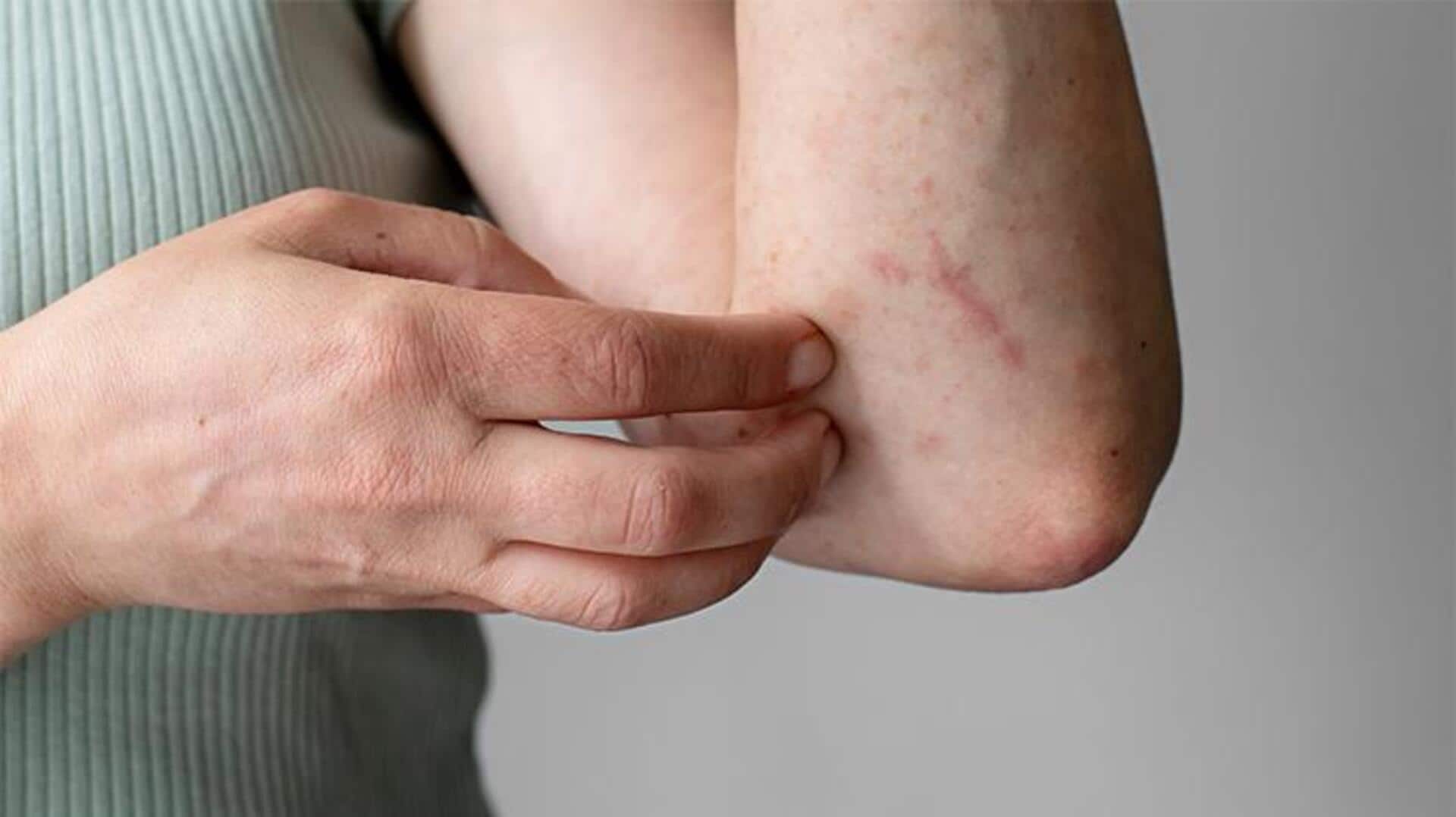 सर्जरी के बाद संक्रमण का संकेत दे सकते हैं ये 5 लक्षण, न करें नजरअंदाज