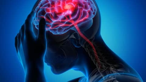 युवा वयस्कों में स्ट्रोक का खतरा बढ़ाने वाले 5 प्रमुख कारण, इन्हें न करें नजरअंदाज