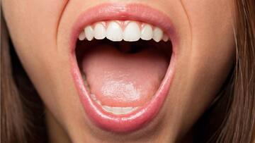 मसूड़ों से खून आने की समस्या से राहत पाने के लिए अपनाएं ये घरेलू नुस्खे