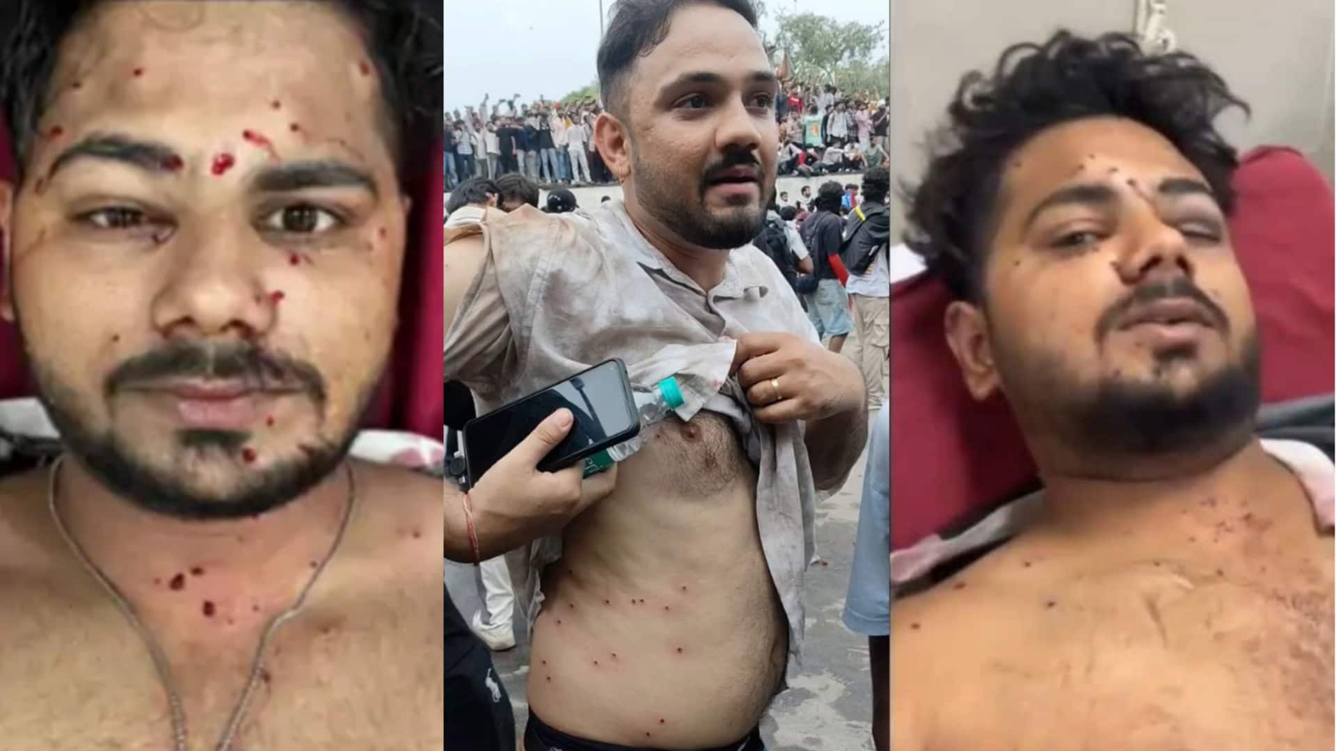 CJP के विरोध प्रदर्शन में 3 लोग पैलेट गन से घायल, CRPF कर रही जांच- रिपोर्ट