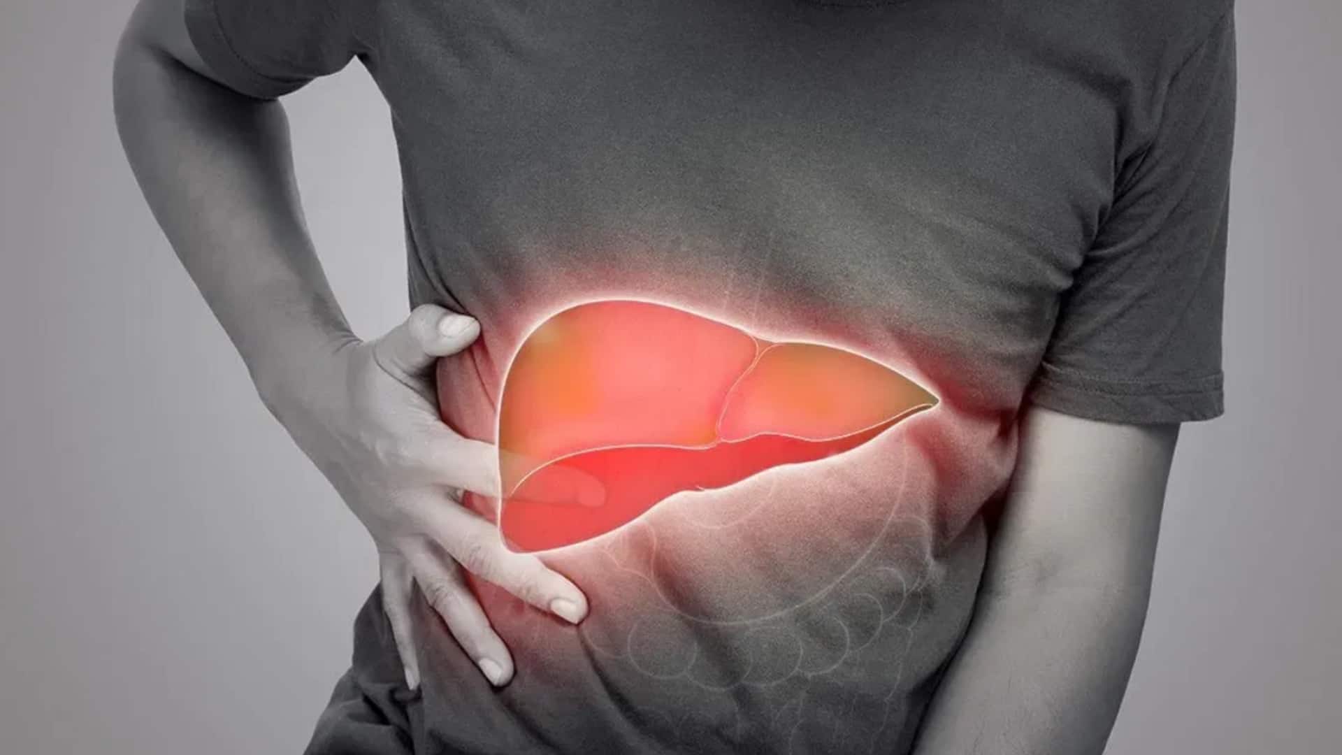 क्या है लीवर सिरोसिस? जानिए इस गंभीर बीमारी के कारण, लक्षण और बचाव के उपाय