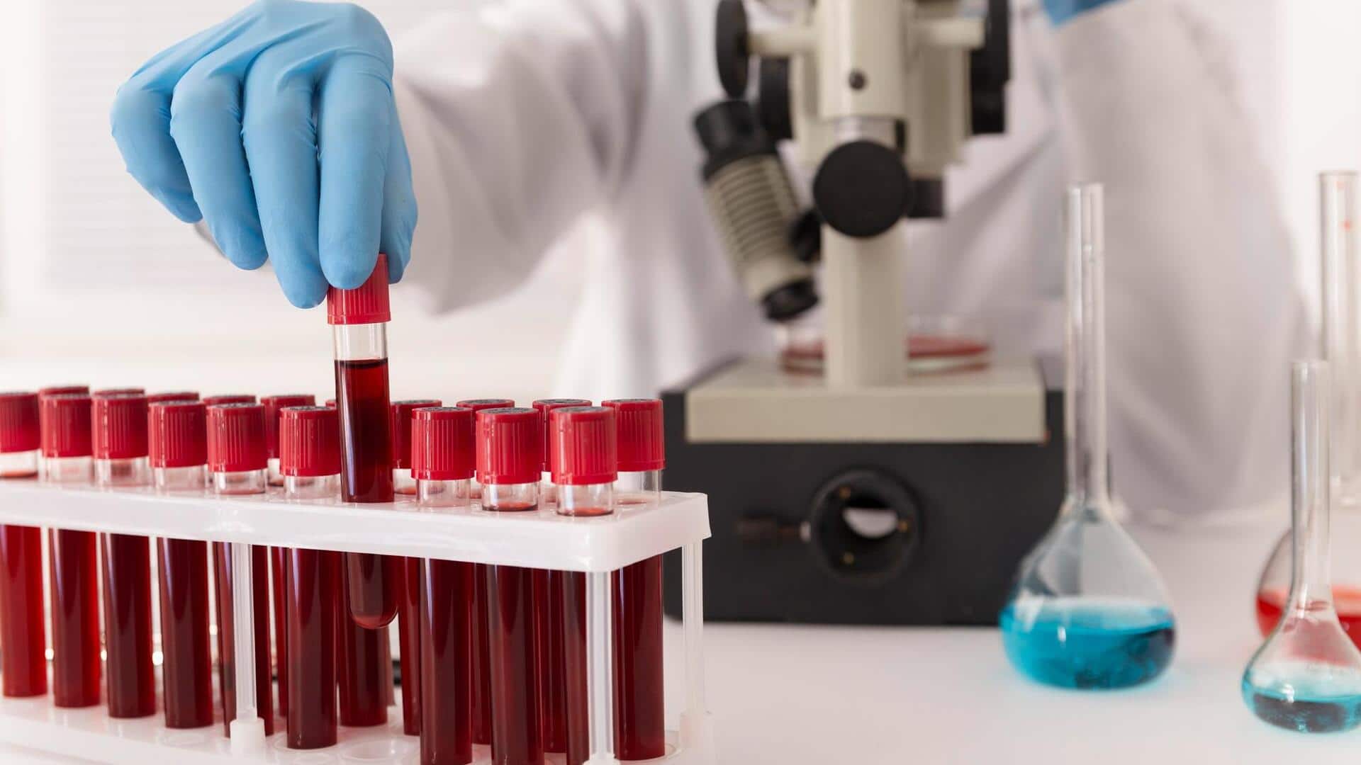 लक्षण दिखने से 10 साल पहले बीमारी को पकड़ लेगा ये ब्लड टेस्ट, जानें कैसे 