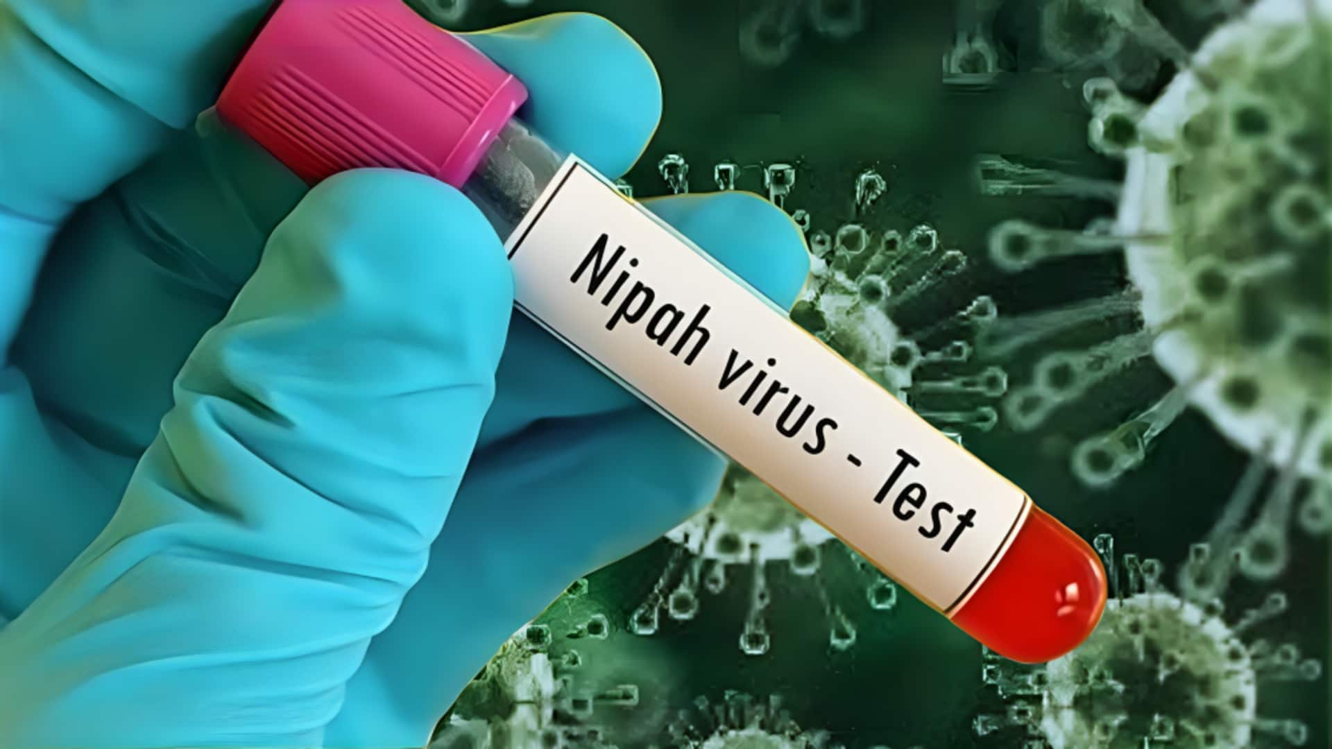 पश्चिम बंगाल में निपाह वायरस का कहर: 3 और संक्रमित मिले, 100 को क्वारेंटाइन किया गया 