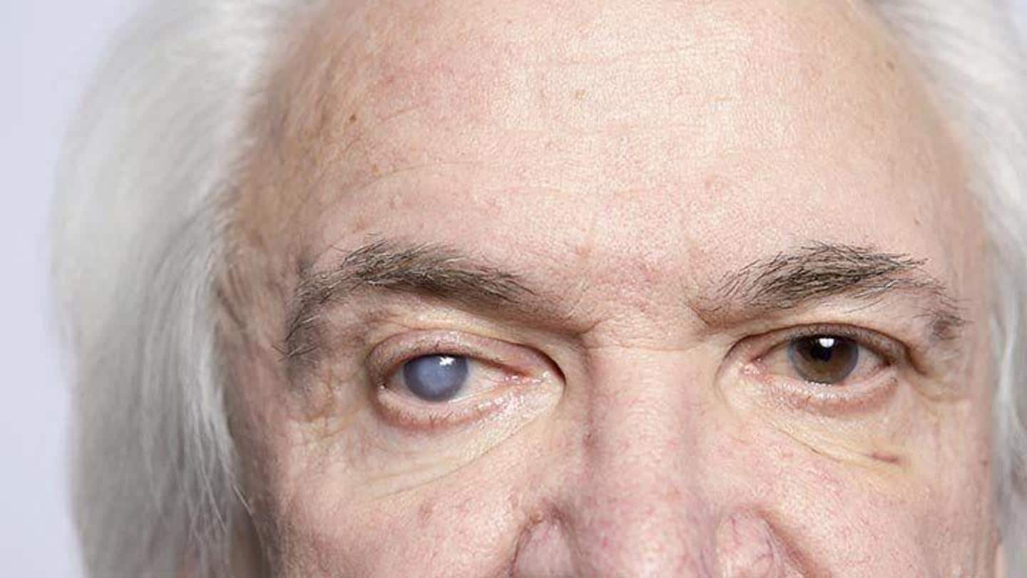 मोतियाबिंद: जानिए आंखों से जुड़ी इस बीमारी के कारण, लक्षण और बचाव के उपाय