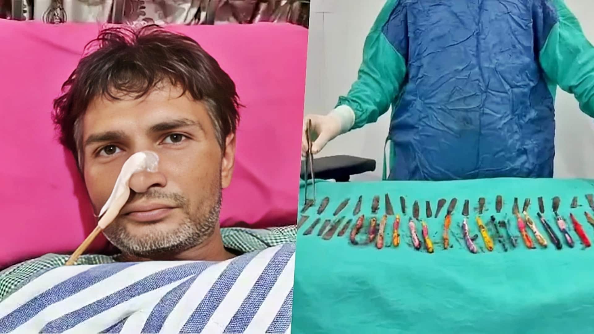 नशा छुड़ाने के लिए भर्ती था मरीज, चम्मच-टूथब्रश और पेन निगलने का आदी बन गया