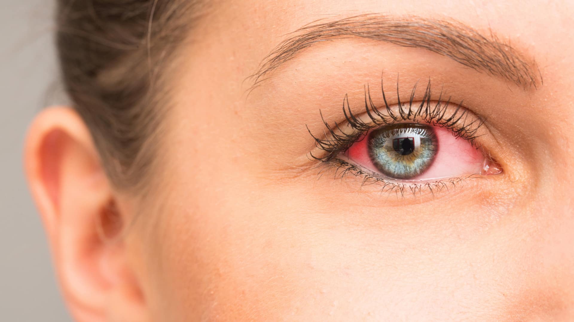 दिल्ली-NCR में बढ़ते प्रदूषण से आंखों को सुरक्षित रखने के लिए अपनाएं ये तरीके