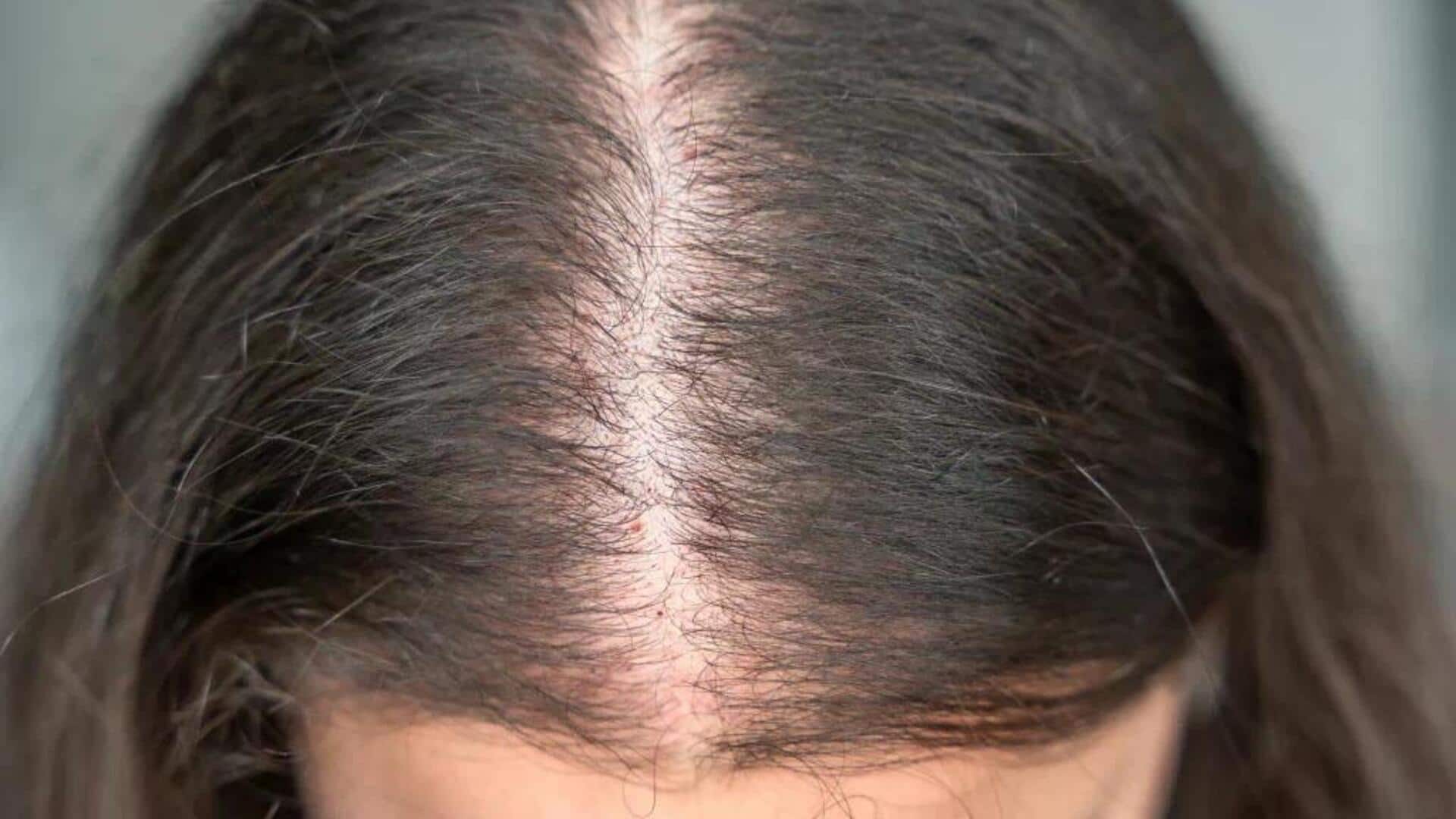 बालों के पतले होने का कारण बन सकती हैं ये 5 आदतें, आज से छोड़ें