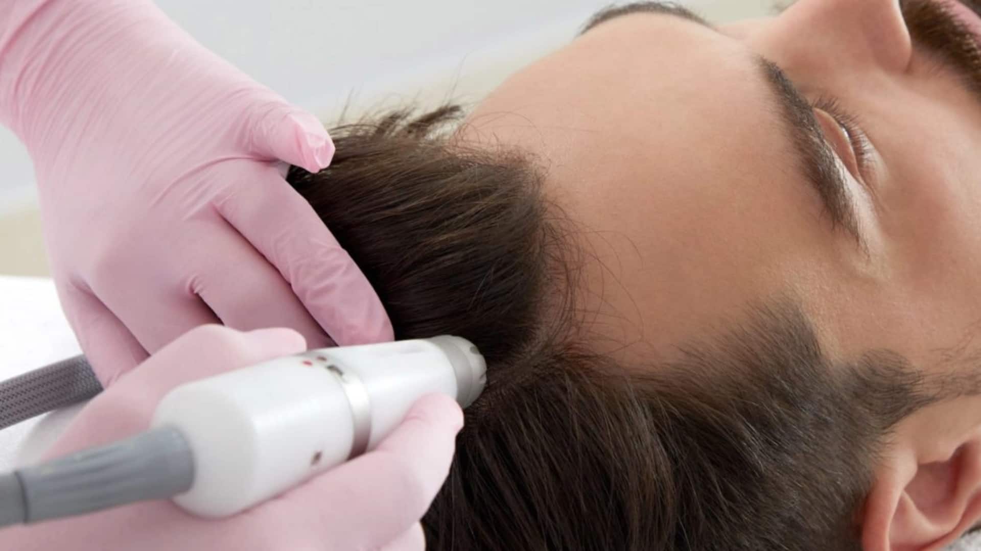 क्या है स्कैल्प हाइड्राफेशियल? जानिए इस प्रक्रिया के फायदे और अन्य जरूरी बातें