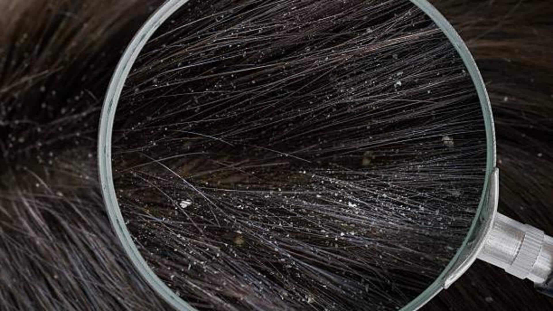 डैंड्रफ से जुड़े इन भ्रमों को न मानें सच, हो सकता है नुकसान