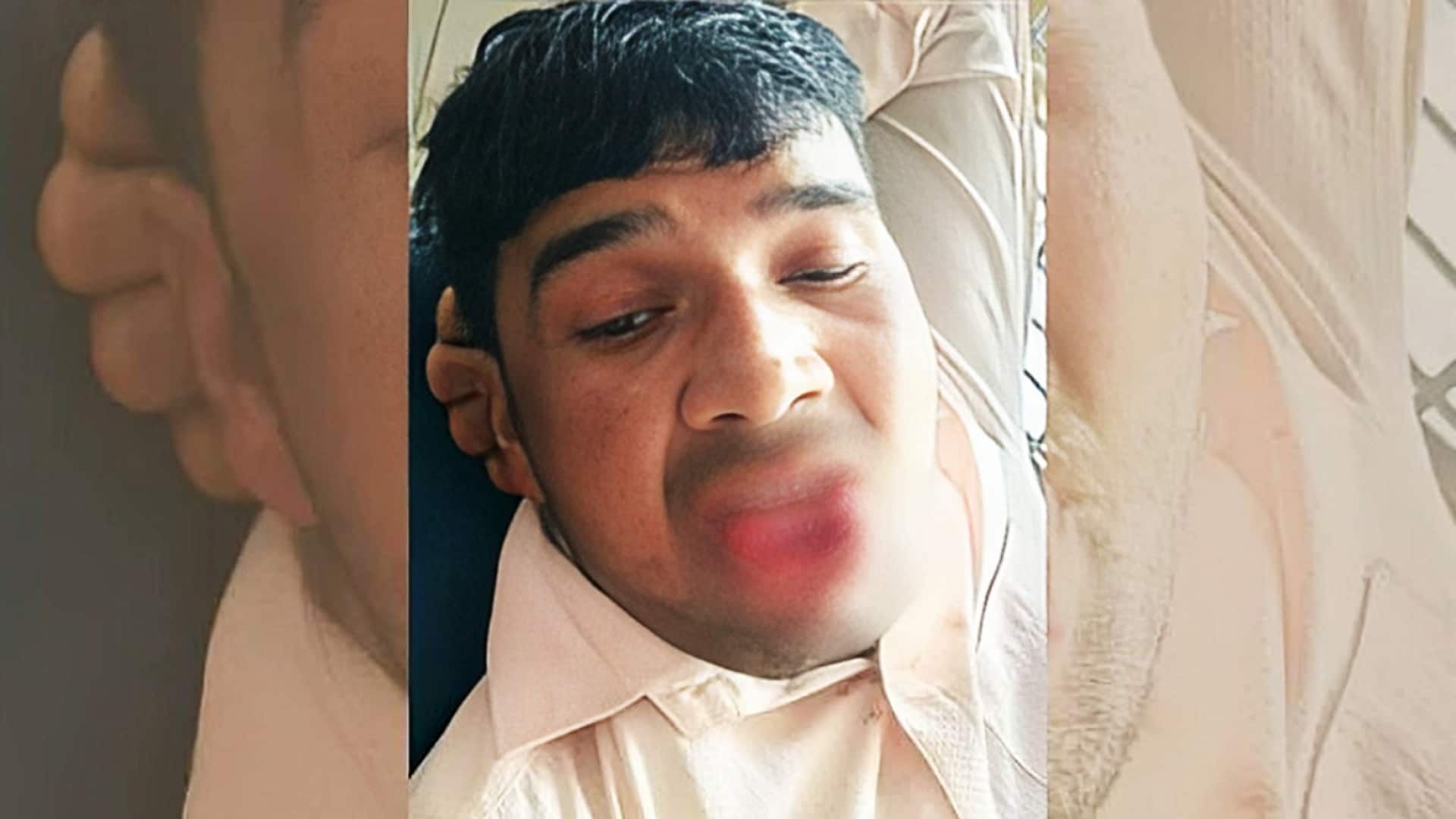 कानपुर के युवक ने पूर्व प्रेमिका को जबरन किस किया, युवती ने काटी जीभ