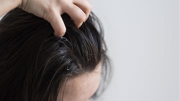 ड्राई स्कैल्प क्या है? इस समस्या से राहत पाने के लिए अपनाएं ये 5 घरेलू नुस्खे