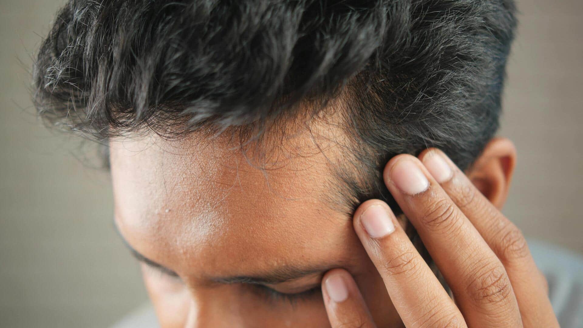 माथे के आसपास होने लगा है गंजापन? जानिए इसके 5 संभावित कारण