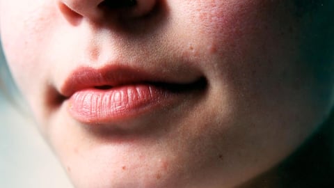 होंठों को अतिरिक्त नमी की जरूरत है? इन 5 संकेतों से लगाएं पता