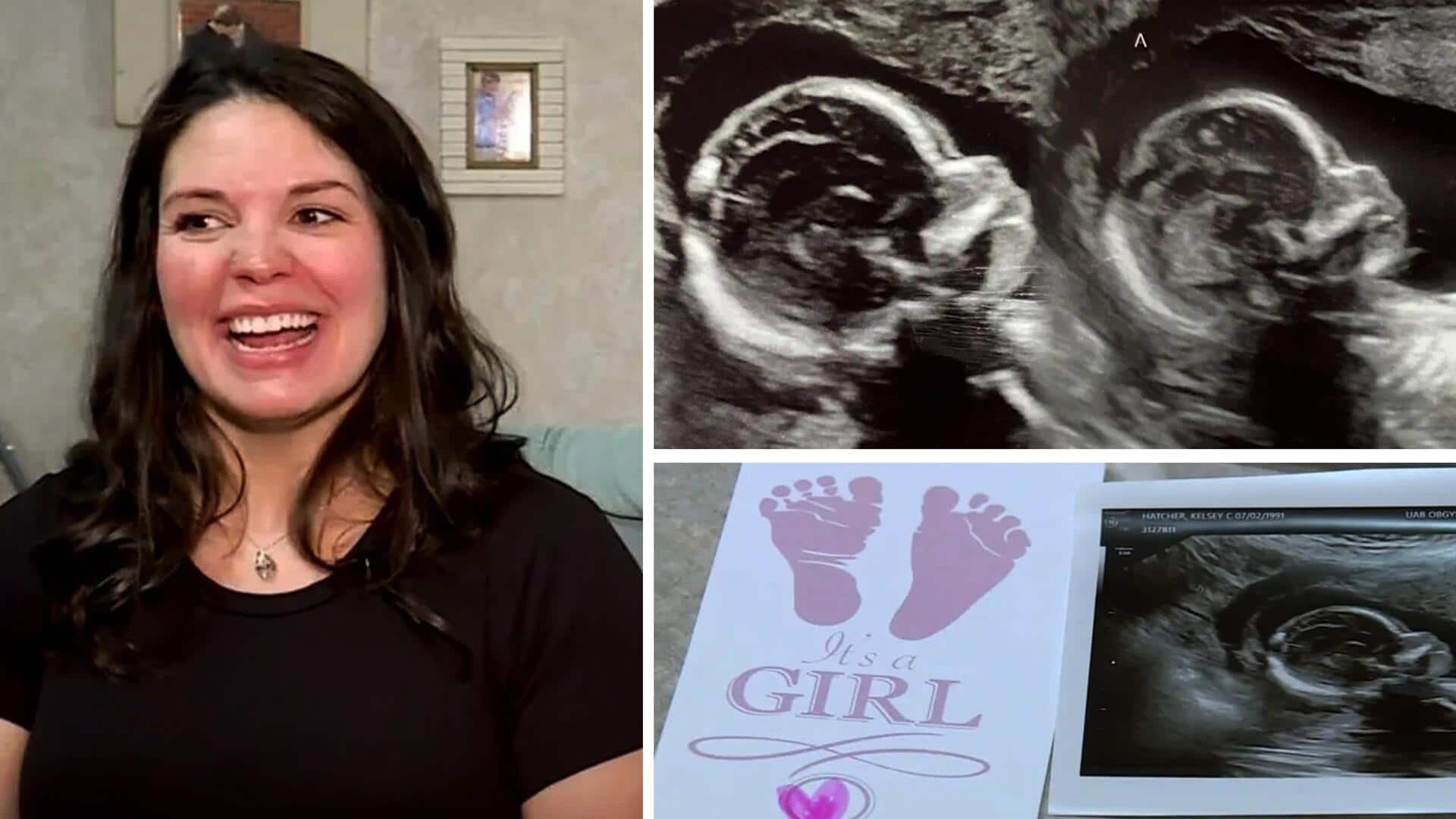 अमेरिका: 2 कोख वाली महिला हुई गर्भवती, दोनों में बच्चा; बेहद दुर्लभ मामला