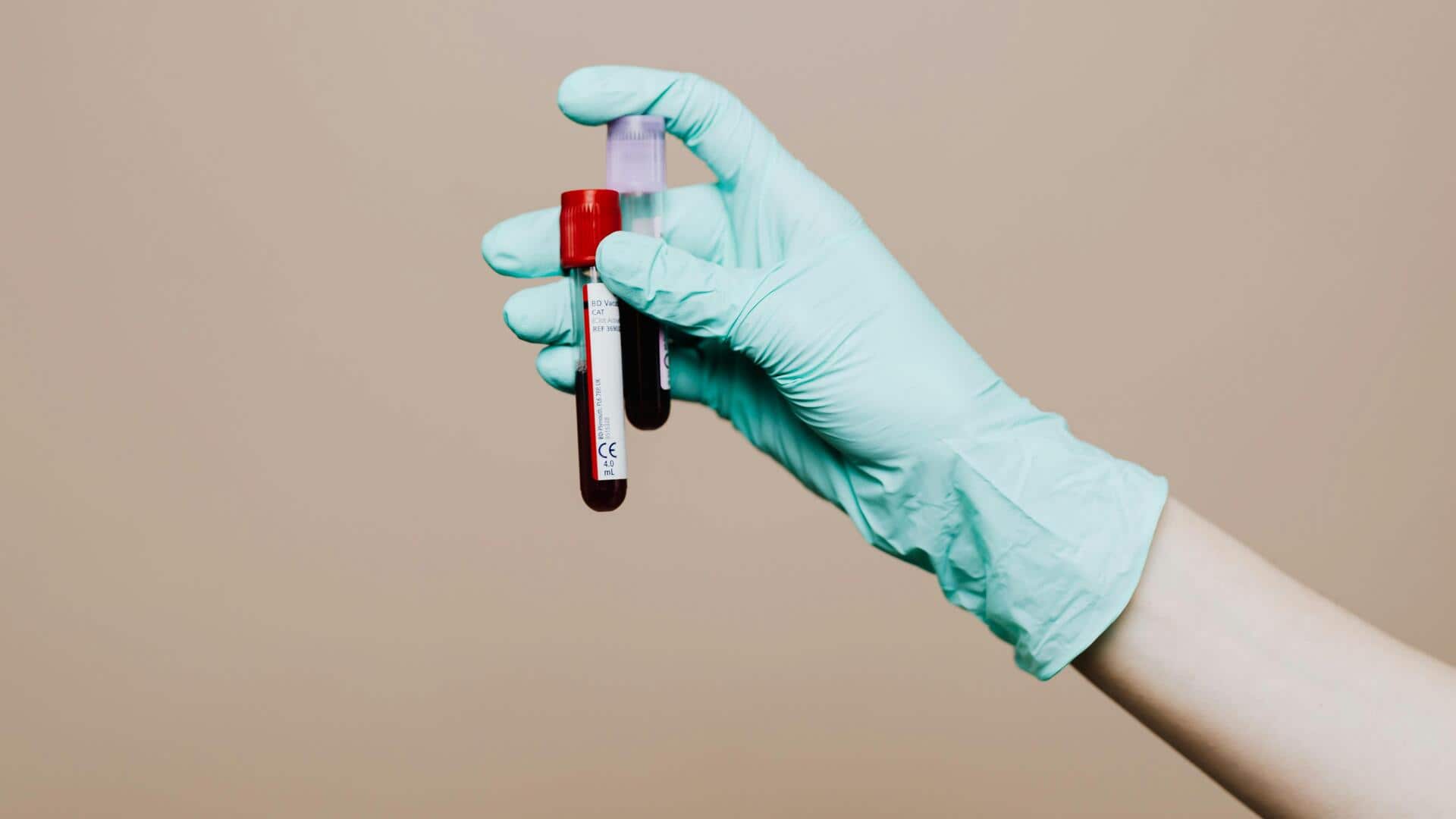 ब्लड टेस्ट के पहले नजरअंदाज न करें दिल से जुड़े ये चेतावनी संकेत