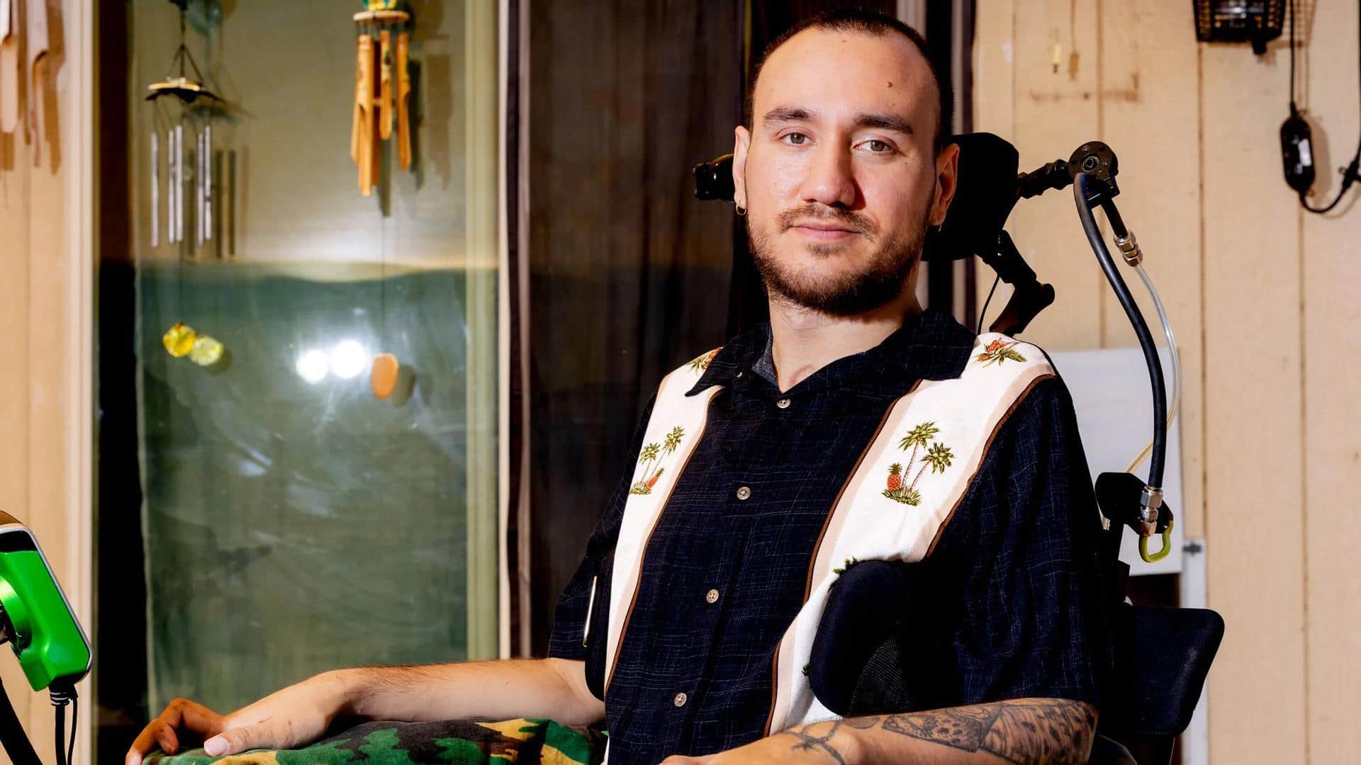 न्यूरालिंक चिप के साथ नोलैंड आर्बॉ के 100 दिन पूरे, अनुभव किया साझा