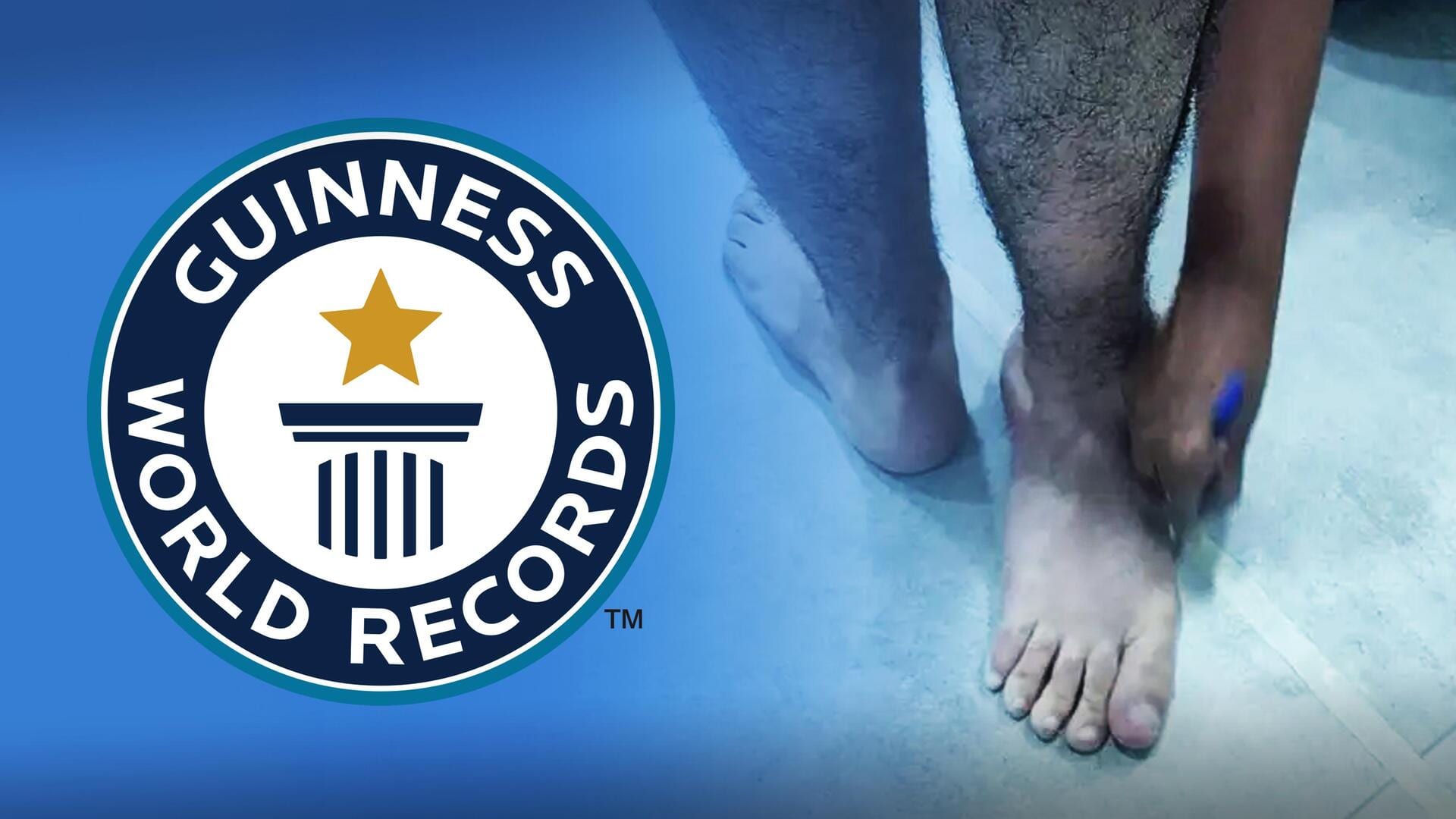 ब्राजील: यह व्यक्ति उल्टे कर लेता है अपने पैर, 210 डिग्री घुमाकर बनाया विश्व रिकॉर्ड 