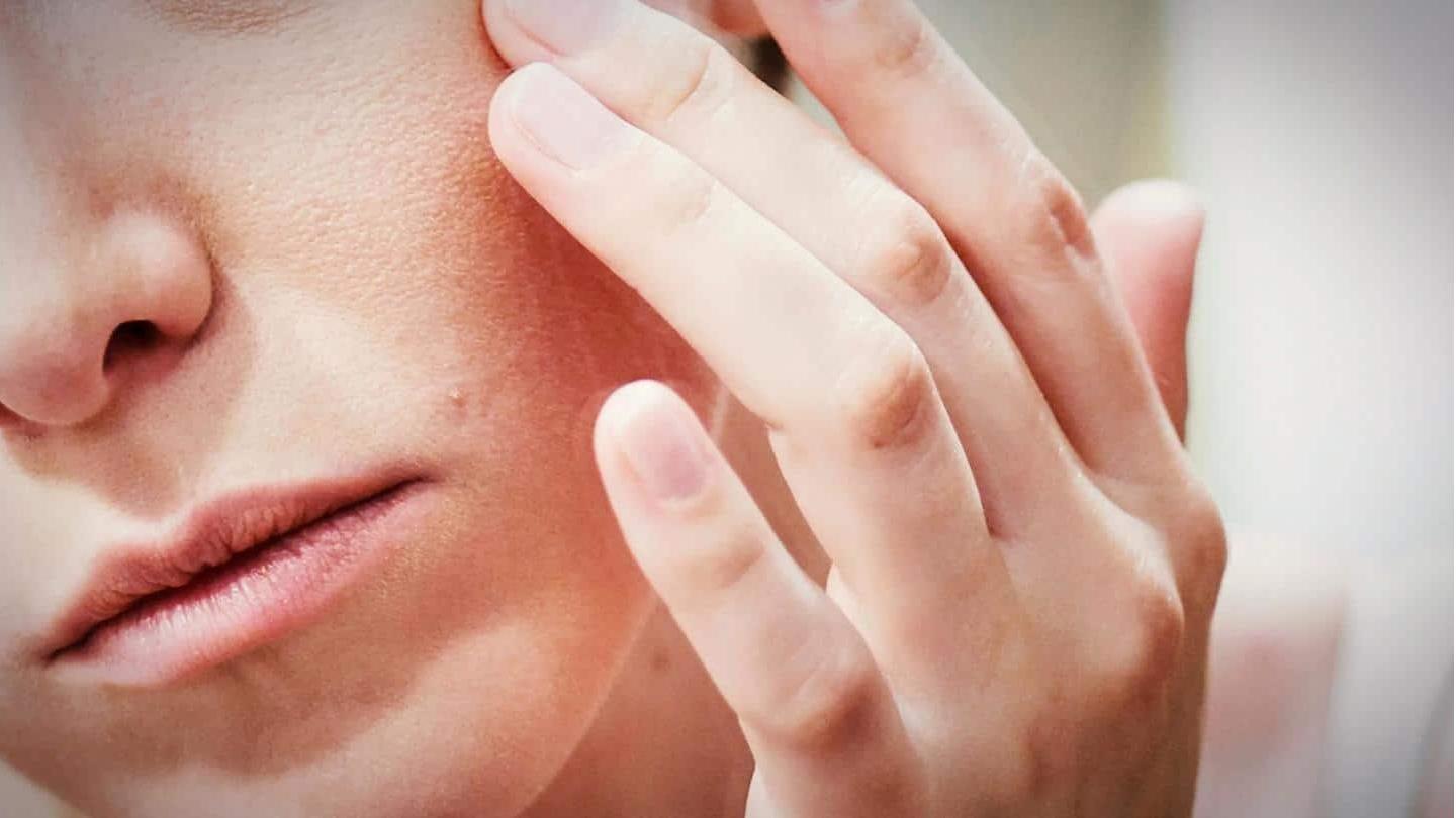 त्वचा पर हो सकती है एलर्जी त्वचा पर हो सकती है एलर्जी